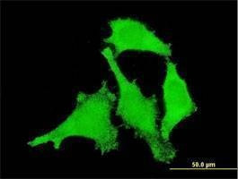Anti-ANKRD17 Antibody