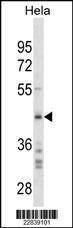 Anti-SPARC (C-term) (Ascites) Antibody