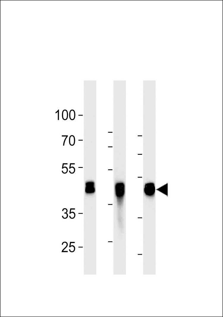 Anti-CYK18 (C-term) Antibody
