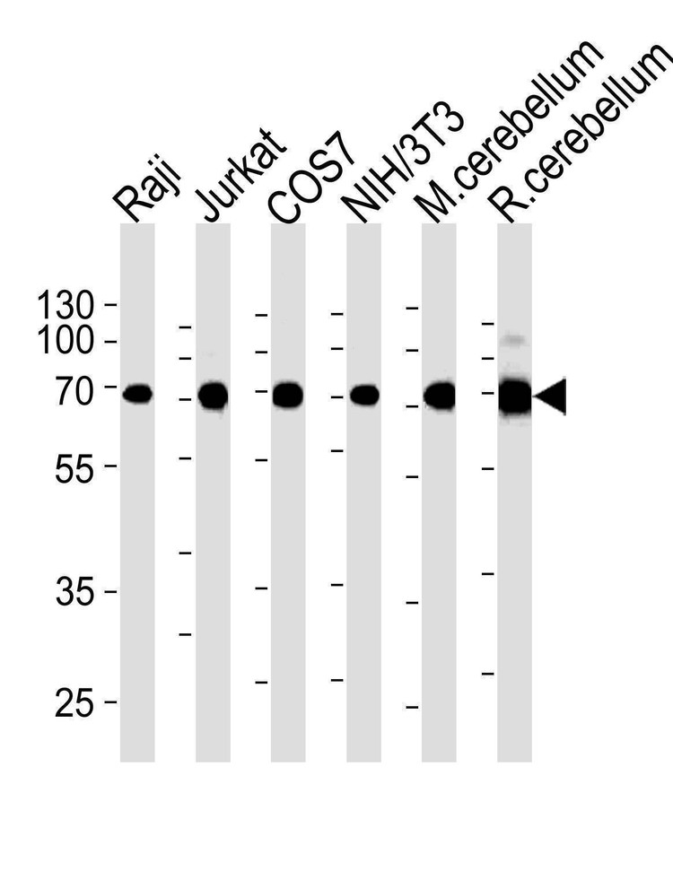 Anti-ACHE (C-term) Antibody