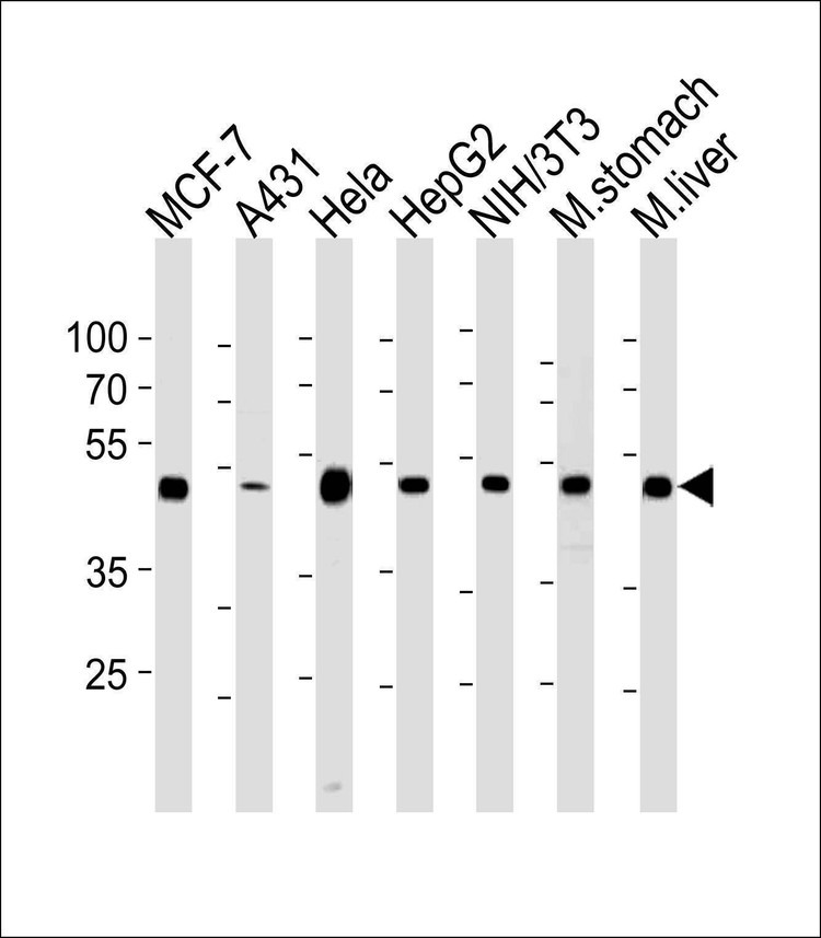 Anti-ENO1 Antibody