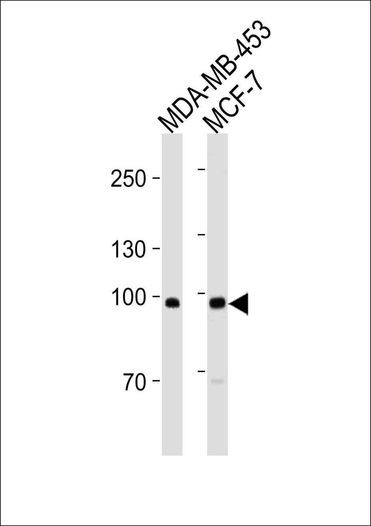 Anti-ACE2 (SARS Receptor) (Center) (Ascites) Antibody