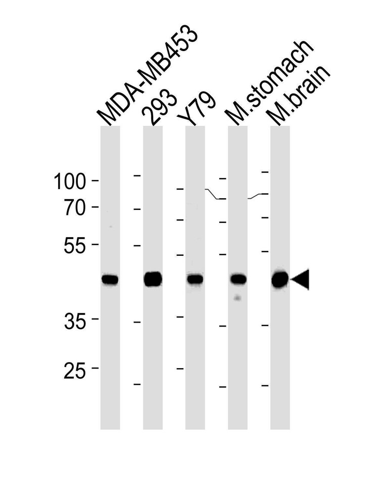 Anti-Creatine Kinase BB (Center) Antibody
