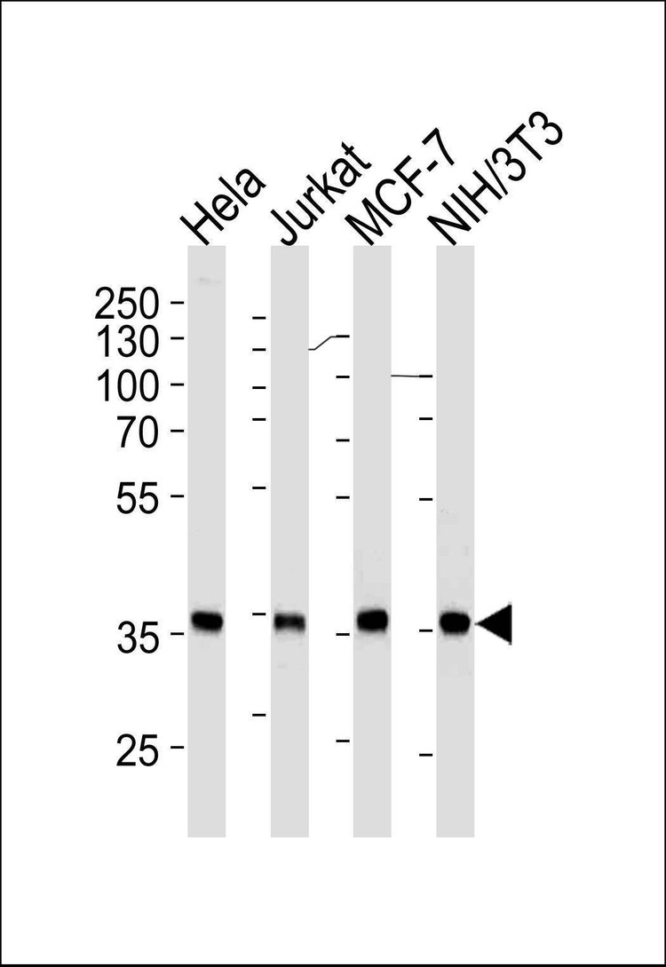Anti-NPM1 Antibody