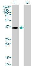 Anti-ANXA1 Antibody