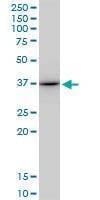 Anti-ANXA1 Antibody
