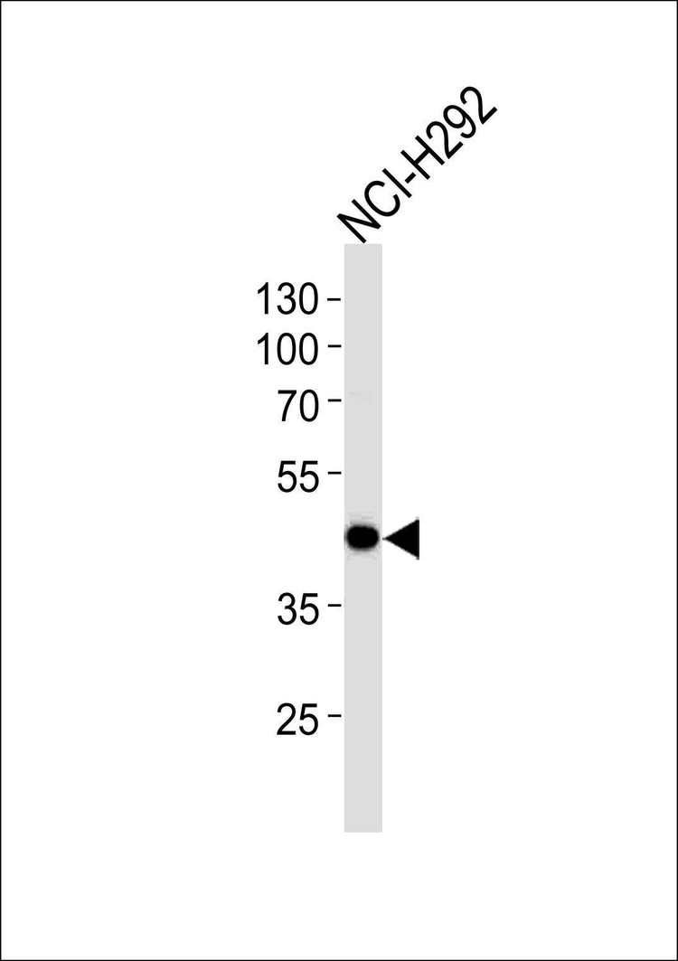 Anti-AIM2 Antibody