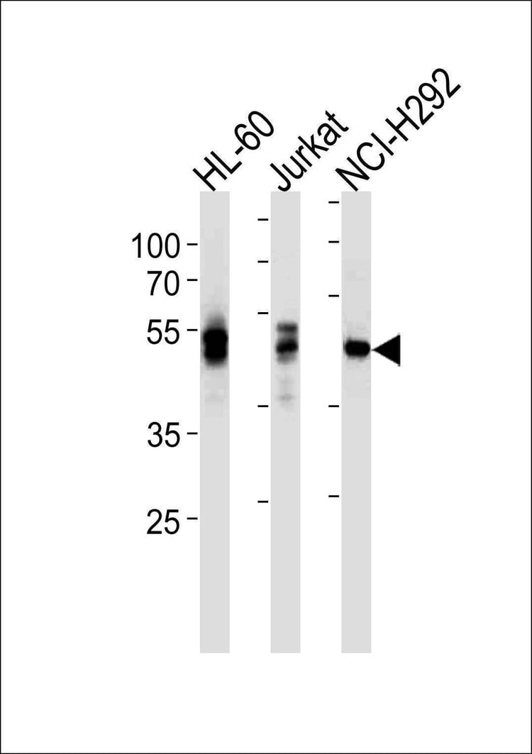 Anti-LCK (Ascites) Antibody