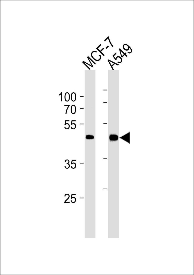 Anti-CCRK (N-term) Antibody
