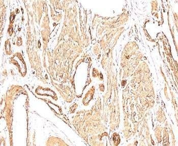 Anti-Smooth Muscle Actin Antibody, Sodium Azide Free