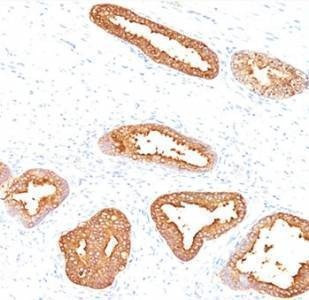 Anti-PSA Antibody Prostate Specific Antigen, Sodium Azide Free