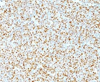 Anti-Cyclin D1 Antibody