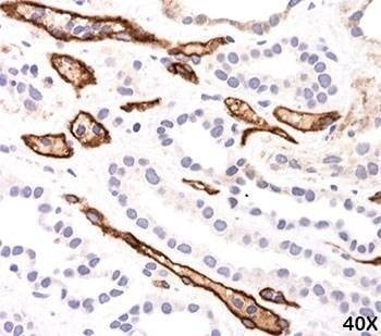 Anti-C4d Antibody Complement 4d, Sodium Azide Free