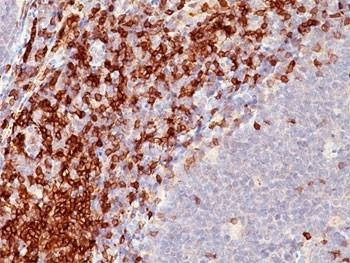 Anti-CD5 Antibody, Sodium Azide Free