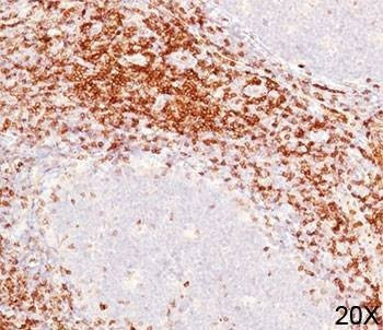 Anti-CD6 Antibody