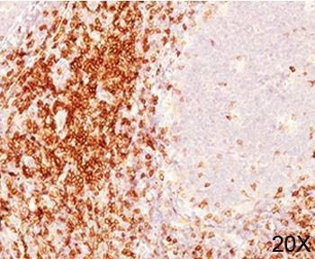 Anti-CD6 Antibody Cocktail