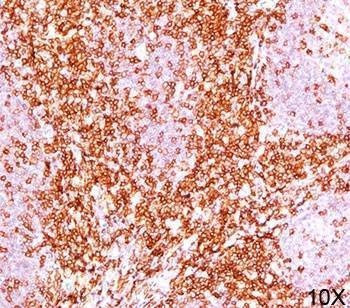Anti-CD6 Antibody Cocktail, Sodium Azide Free
