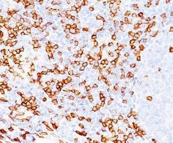 Anti-CD8a Antibody