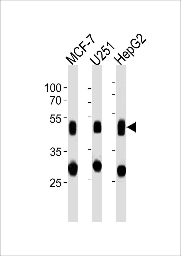 Anti-CTSD Antibody