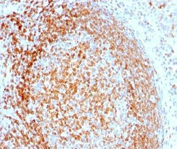 Anti-CD74 Antibody