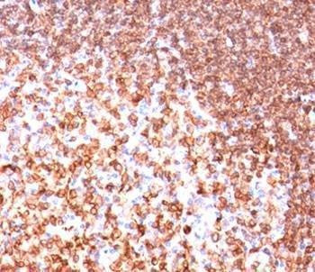 Anti-CD74 Antibody