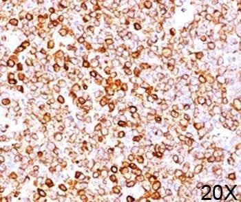 Anti-CD79a Antibody, Sodium Azide Free