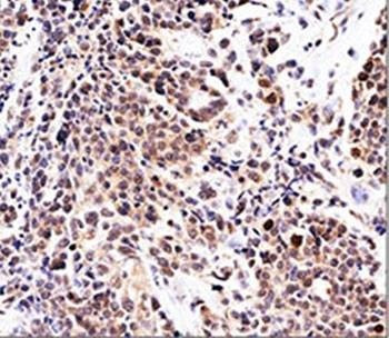 Anti-p21 Antibody, Sodium Azide Free