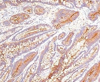 Anti-CEA Antibody, Sodium Azide Free