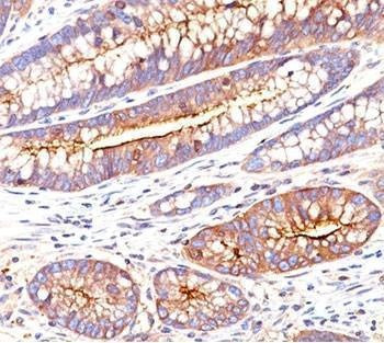 Anti-CEA Antibody, Sodium Azide Free