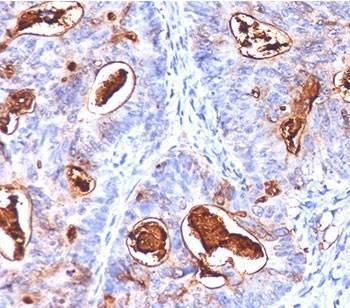 Anti-CEA Antibody Cocktail