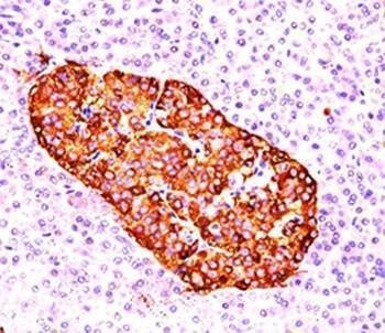 Anti-Chromogranin A Antibody, Sodium Azide Free