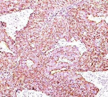 Anti-Chromogranin A Antibody, Sodium Azide Free