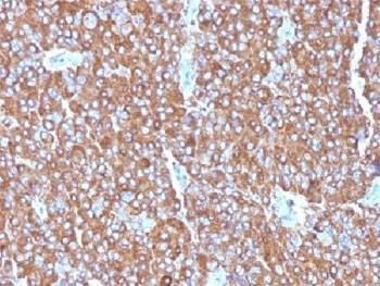Anti-Chromogranin A Antibody Cocktail