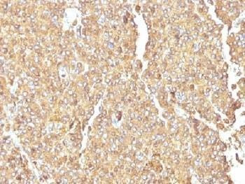 Anti-Chromogranin A Antibody