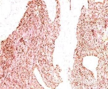 Anti-Chromogranin A Antibody, Sodium Azide Free