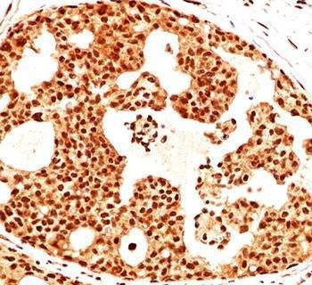 Anti-Estrogen Receptor beta Antibody, Sodium Azide Free