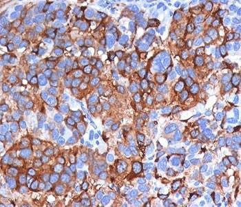 Anti-Melan-A Antibody, Sodium Azide Free