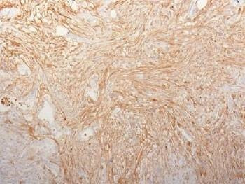 Anti-Fibronectin Antibody, Sodium Azide Free