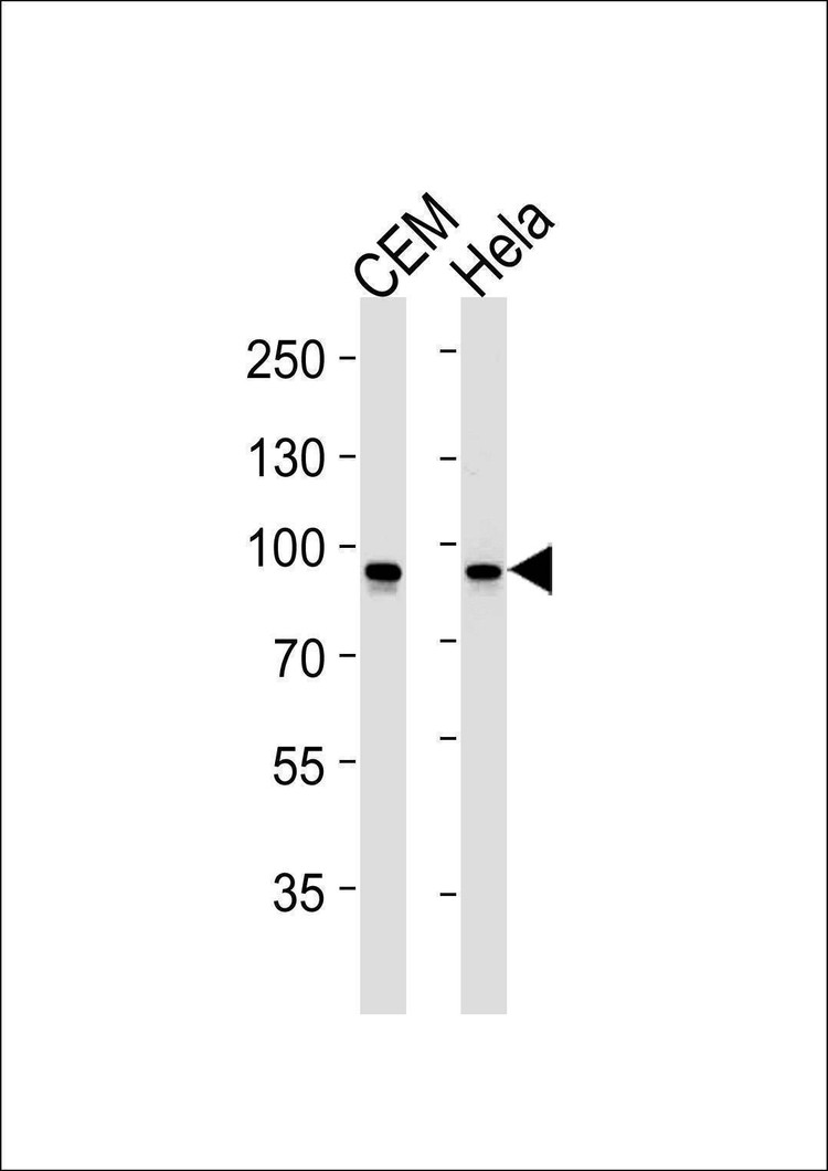 Anti-STAT1 Antibody