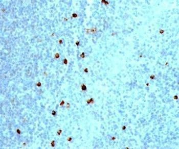 Anti-IgM Heavy Chain Antibody