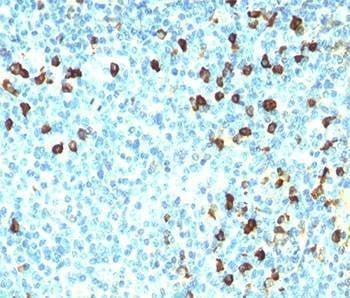Anti-Lambda Light Chain Antibody, Sodium Azide Free