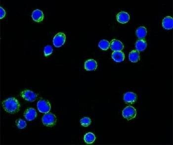 Anti-Lambda Light Chain Antibody