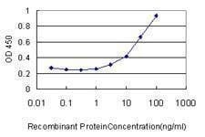 Anti-AP1S2 Antibody