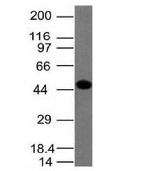 Anti-Cytokeratin 8 Antibody