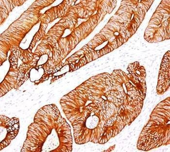 Anti-Cytokeratin 8 Antibody