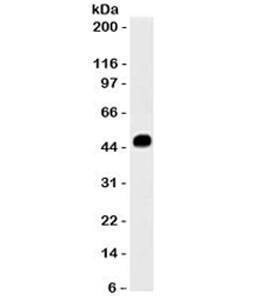 Anti-KRT8 Antibody, Sodium Azide Free