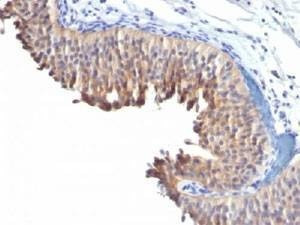 Anti-Cytokeratin 10 Antibody