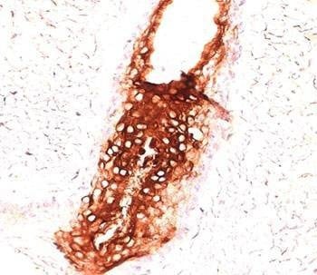 Anti-Cytokeratin 17 Antibody