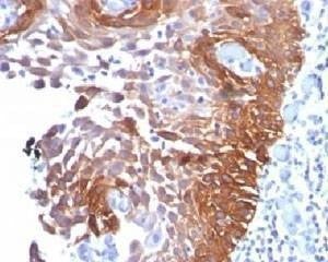 Anti-Cytokeratin 17 Antibody