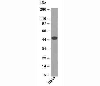 Anti-Cytokeratin 18 Antibody